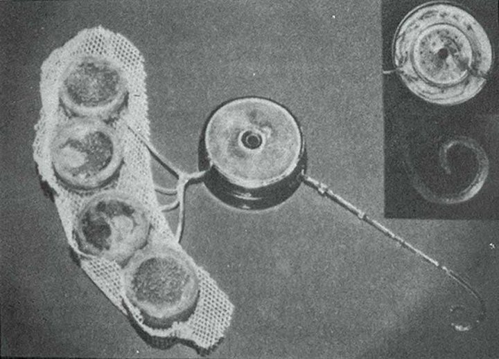 Grayscale zoomed in image of a cochlear device
