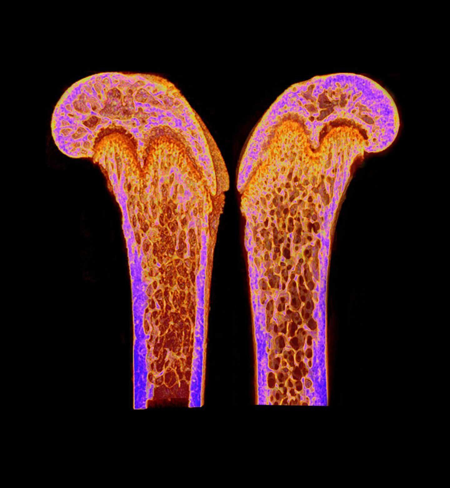 a bone scan image