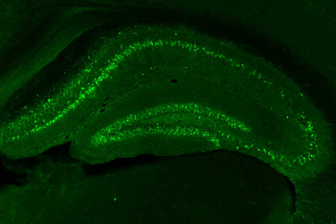 A graphic of tau in a mouse brain; a large green image folded over a smaller one