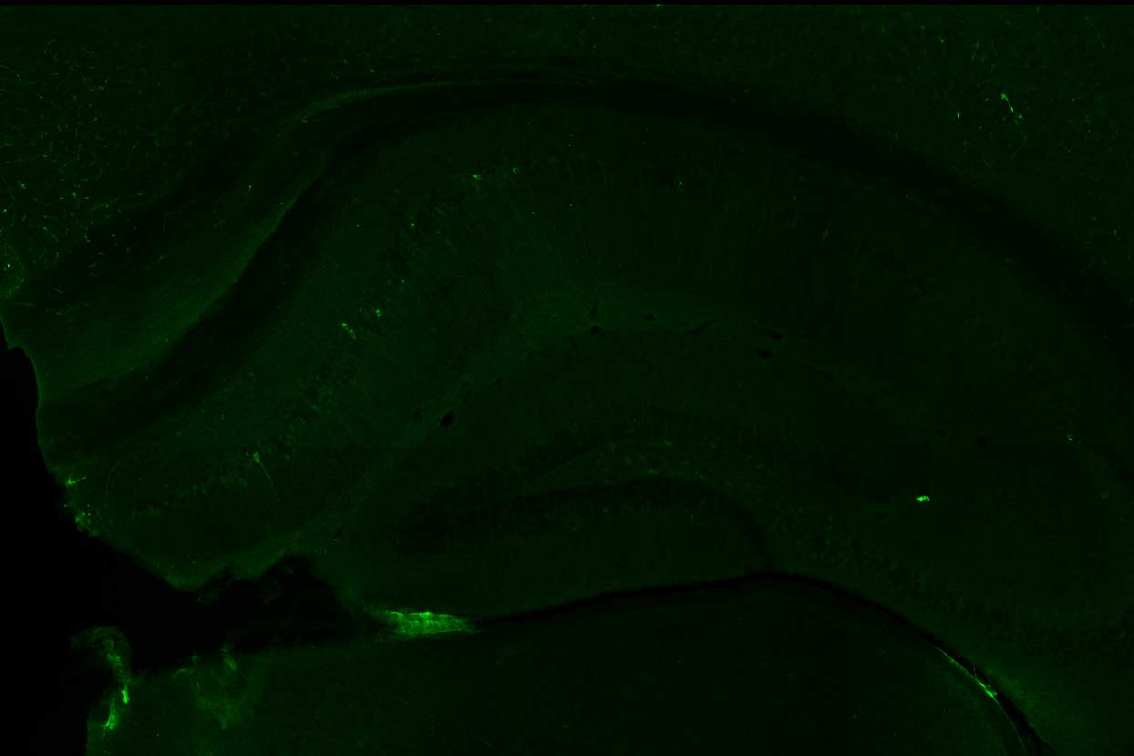 A mostly dark, far less green, image of tau in a mouse brain when the combination of letrozone and irinotecan is administered