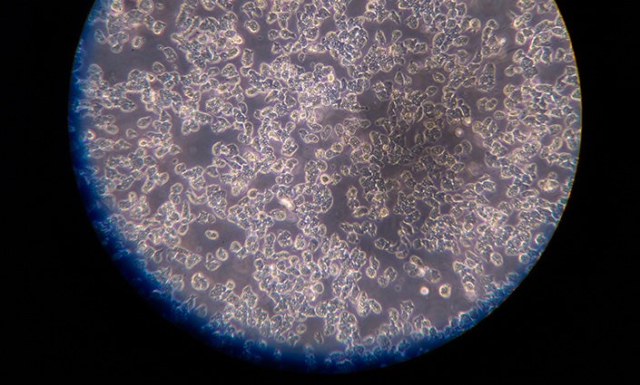 An image taken by a microscope of tiny amoebas