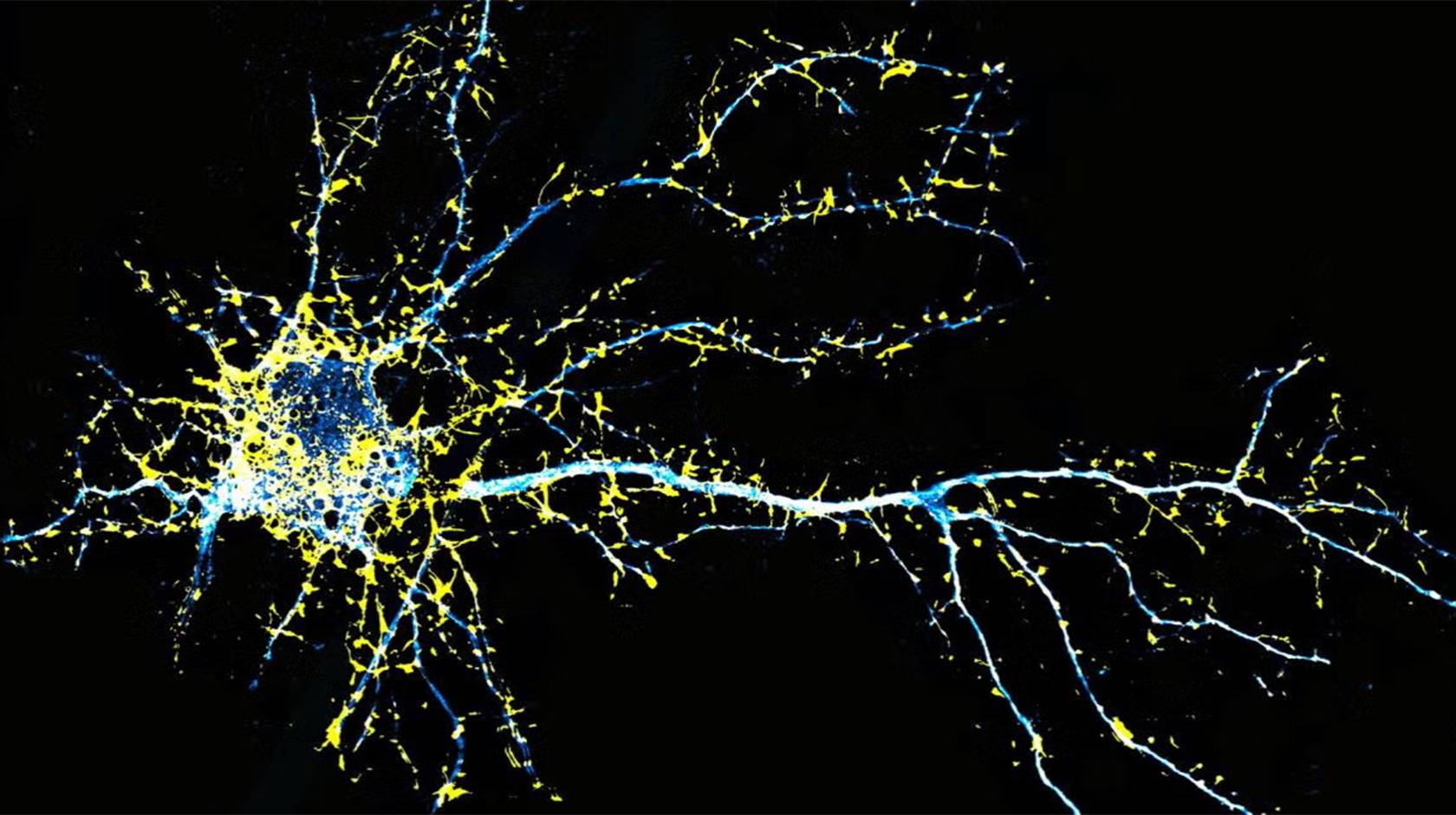 Illustration of a neuron colored in yellow and blue against a black background