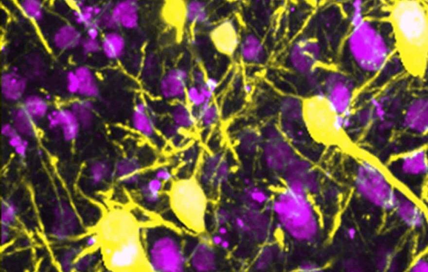 neurons imaged in bright pink and yellow colors